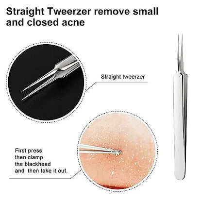 Professional Facial Blackhead Remover Tweezers